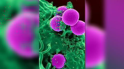 Representative image