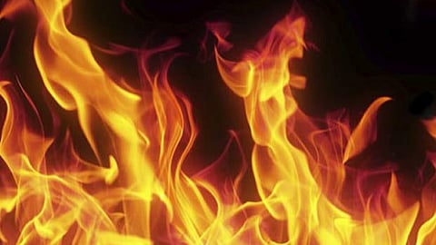 Representative Image