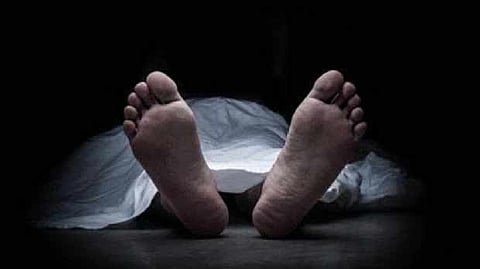 Representative Image