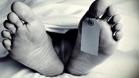 Representative image