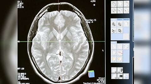 Representative image