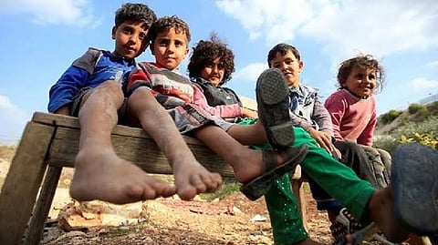 Representative image