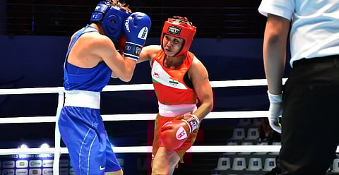 Representative image