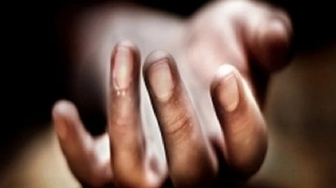 Representative Image