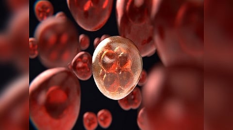 Representative Image