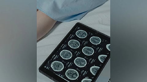 Representative image