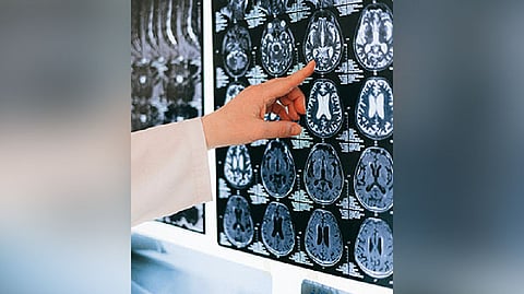 Representative image