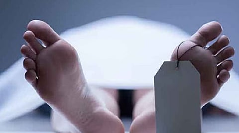 Representative image