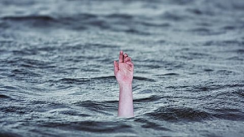 Representative Image