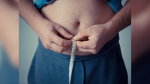 Representative image