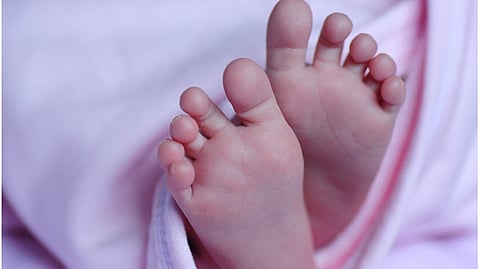 Representative image