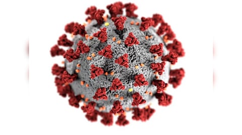 Representative Image