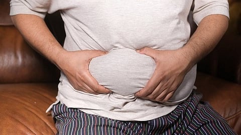 Representative image