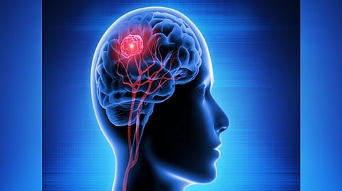 Representative Image