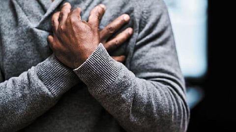 Representative image