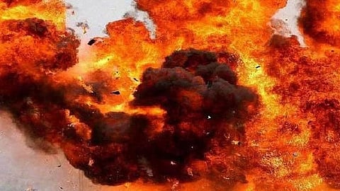 Representative image