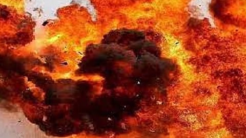 Representative Image