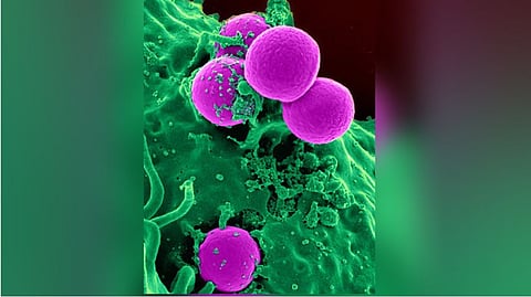 Representative image