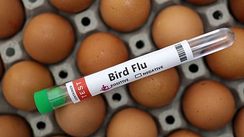 Representative image