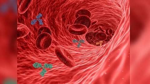 Representative image