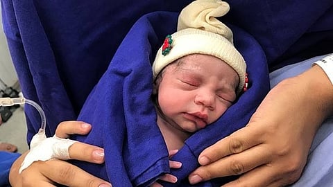 Representative Image