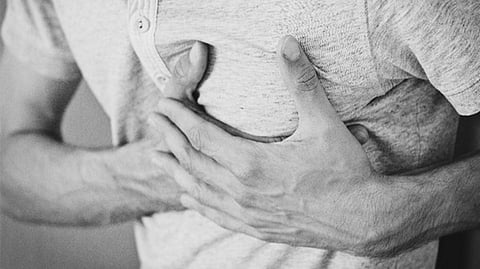 Representative image