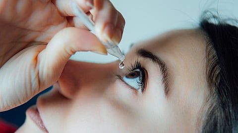 Representative image