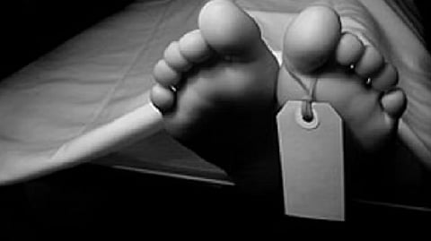 Representative image