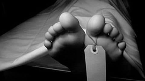 Representative Image