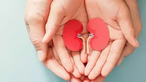 Representative image