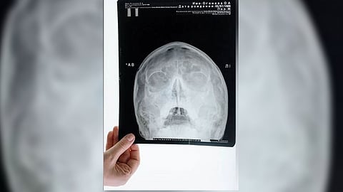 Representative Image