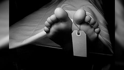 Representative Image