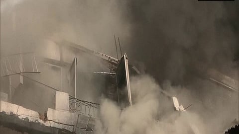 Representative image