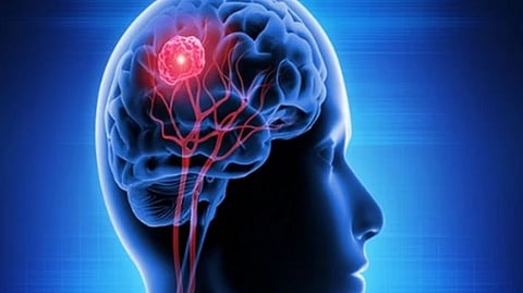 Representative Image