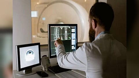 Representative image