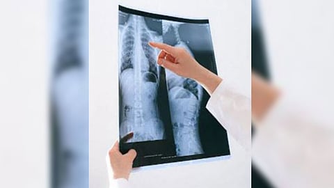 Representative Image