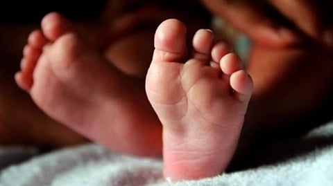 Representative Image