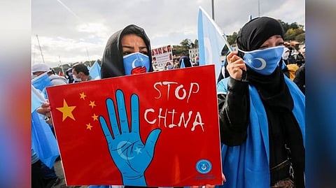 Representative Image