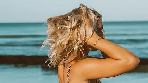 Representative image