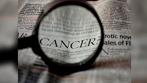 Representative Image