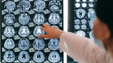 Representative Image