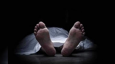 Representative image