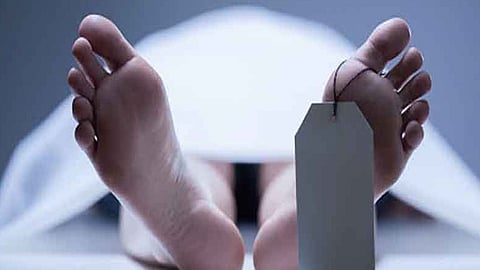 Representative image