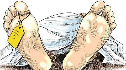 Representative Image