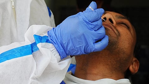 Representative image