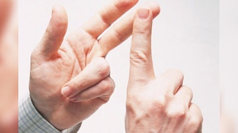 Representative image