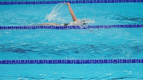 Representative image