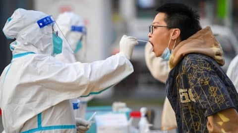 Representative image