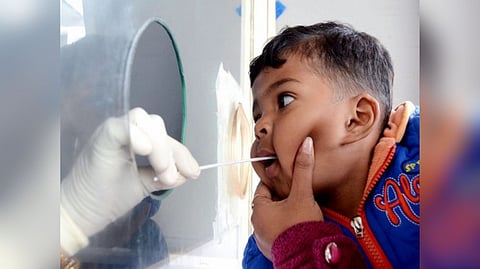 Representative image