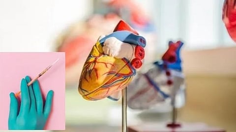 Representative image